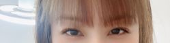 -U-Nail