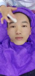 -资医堂专业袪痘袪斑