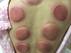 -张钰强中医正骨推拿连锁(华发商都店)