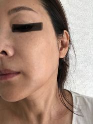 -八大处整形