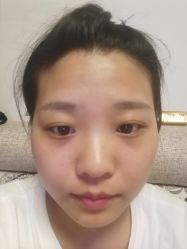 体验后-坤如玛丽·医疗美容中心