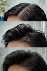 点击看大图 -GANO HAIR