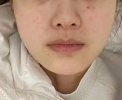 -洁铭新加坡医美