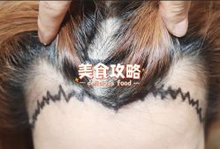 -大麦微针植发全国连锁