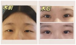 -素美医疗美容·西南眼鼻整形·修复基地