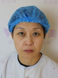 体验前-紫洁俪方（北京）医疗美容