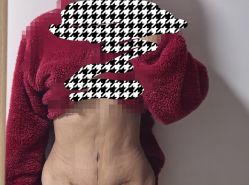 -成都西区医院整形美容