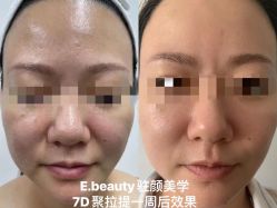 点击看大图 -E.beauty驻颜·痘敏肌调理中心