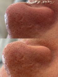 -skin79皮肤管理中心