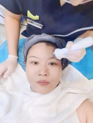 体验前-More摩尔医美の注射线雕光电中心