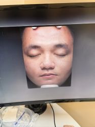 体验后-三亚维多利亚医疗美容医院