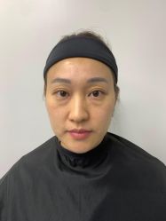 -广州健丽·去眼袋医疗美容机构