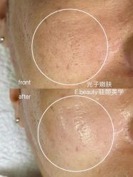 -E.beauty驻颜·痘敏肌调理中心