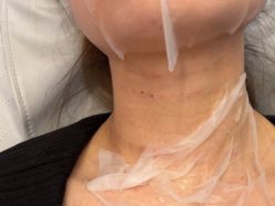 -美瑞莎创美医疗美容