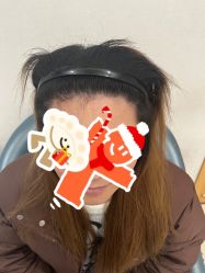 -大麦微针植发丨全国连锁