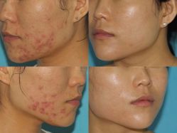 体验前-上海漾颜医疗美容