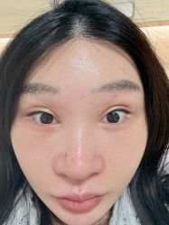 -广州紫馨整形外科医院