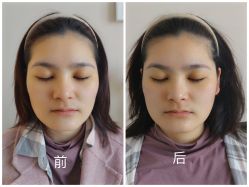 -颜和骨正·明哲式骨相美学整骨