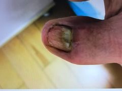 -郑远元专业修脚房(宣化路店)