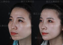 -北京米扬丽格医疗美容·联合丽格鼻整形中心