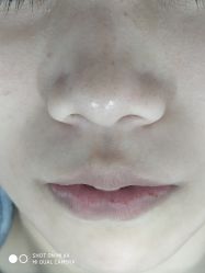 -杭州星婉馨悦医疗美容