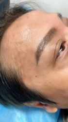 -尚玲纹绣纹眉特价店