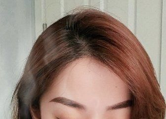 -大麦微针植发丨全国连锁