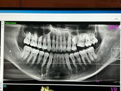 -土豆口腔(凤凰北总店)
