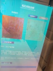 -SKIN79皮肤管理中心