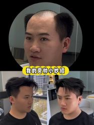 -唐风采假发补发定制