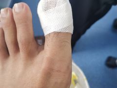 -祖传修脚甲沟炎灰指甲鸡眼