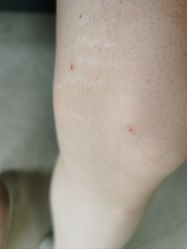 -SKIN79皮肤管理中心