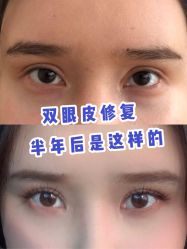 -上海漾颜医疗美容