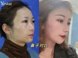 -Yestar艺星医疗美容医院