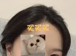 -大麦微针植发全国连锁