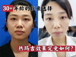 -上海时光整形外科医院