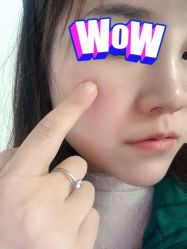 体验后-容丽妍医疗美容
