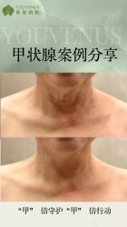 -半岛故事·法儿曼抗衰·indiba中心