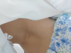体验后-重庆军美医疗美容医院