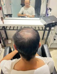 -唐风采假发补发定制