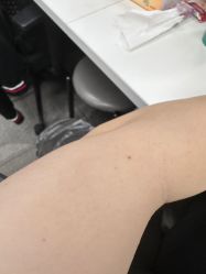 体验前-澳尔颜选医疗美容