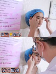 体验前-紫洁俪方（北京）医疗美容