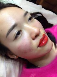 点击看大图 -郡艺医疗美容·微整·眼鼻吸脂