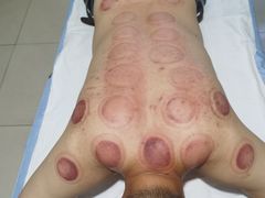 -妙手堂中医推拿按摩