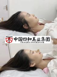 点击看大图 -西施无菌半永久纹绣眉眼影唇轻增发纹发际线