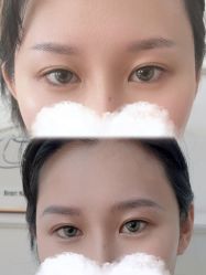 -张小野·专业半永久纹眉