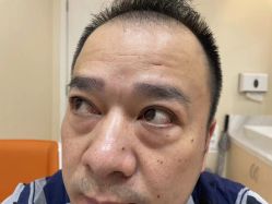 点击看大图 体验前-广州健丽·去眼袋医疗美容机构