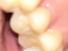 -微笑牙科口腔(三亚迎宾院区)