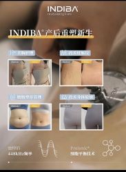点击看大图 -半岛故事·法儿曼抗衰·indiba中心