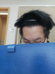 -大麦微针植发丨全国连锁